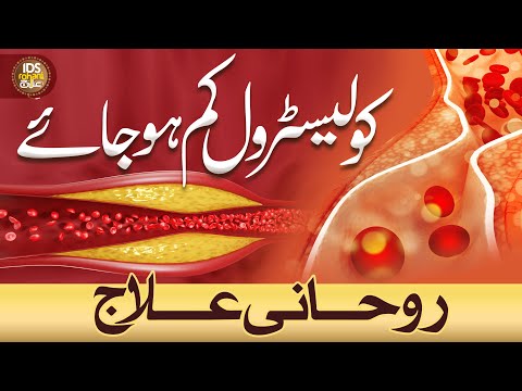 Cholesterol Kam Hojaye Rohani Ilaaj | Wazifa For High Cholesterol | Mufti Ghulam Dastageer