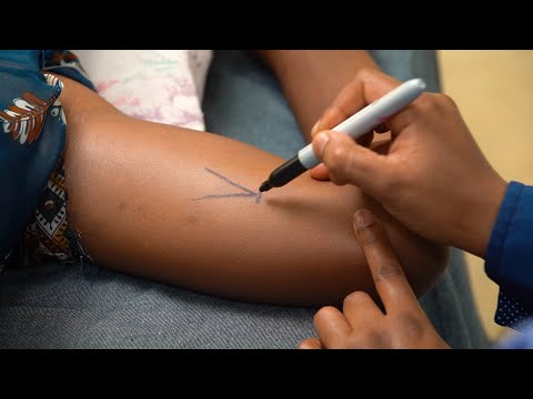 Inserting a Two Rod Implant, Teaching Short (Health Workers), English - Family Planning Series