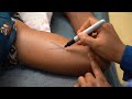 Inserting A Two Rod Implant Teaching Short Health Workers English Family Planning Series