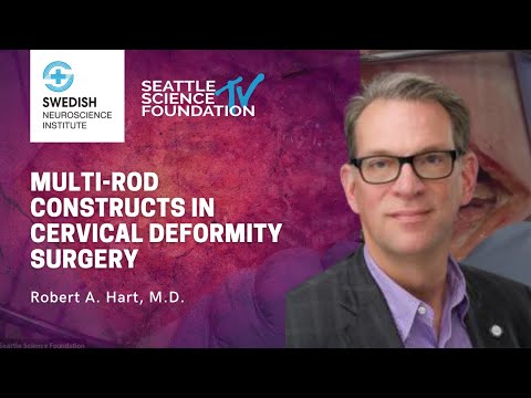 Multi Rod Constructs in Cervical Deformity Surgery- Robert A  Hart, M.D.
