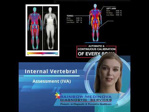 Rainbow Medinova introduces world’s best DXA Scan Hologic Horizon in Nagpur