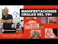 Manifestaciones orales del VIH