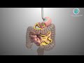 Mini Gastric Bypass Explained In 3D Doctor Obesity Clinic