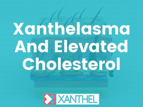 Xanthelasma And Elevated Cholesterol