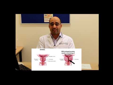 Urethritis- prosztatitis kezelése