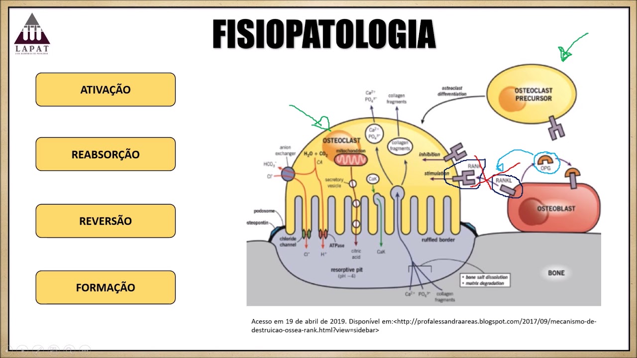 Osteoporose - Vídeo-Aulas LAPAT