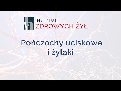 Pończochy uciskowe i żylaki