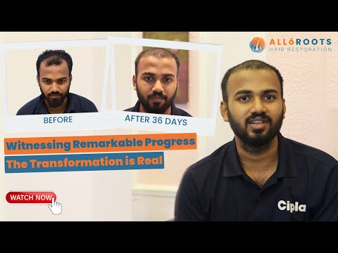 Patient testimonial