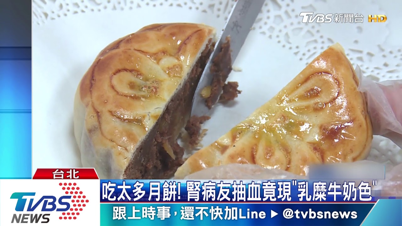 吃太多月餅！　腎病友抽血竟現「乳糜牛奶色」