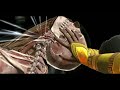 Mortal Kombat 11 Mobile XRay Tanya