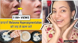 कितने भी मुश्किल झाइयाँ Hyperpigmentation Melasma काले धब्बे Spots हो, इस Remedy से होगा 100% इलाज |