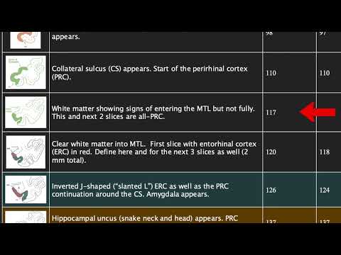 Manual Segmentation: Identifying Landmarks