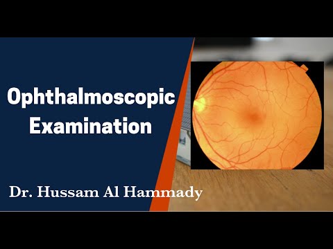 Station 5: Ophthalmoscope & Diabetic Retinopathy For MRCP UK PACES