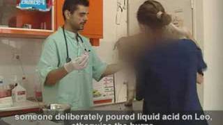 Leo's recovery - Stray dog in Greece doused in Acid.