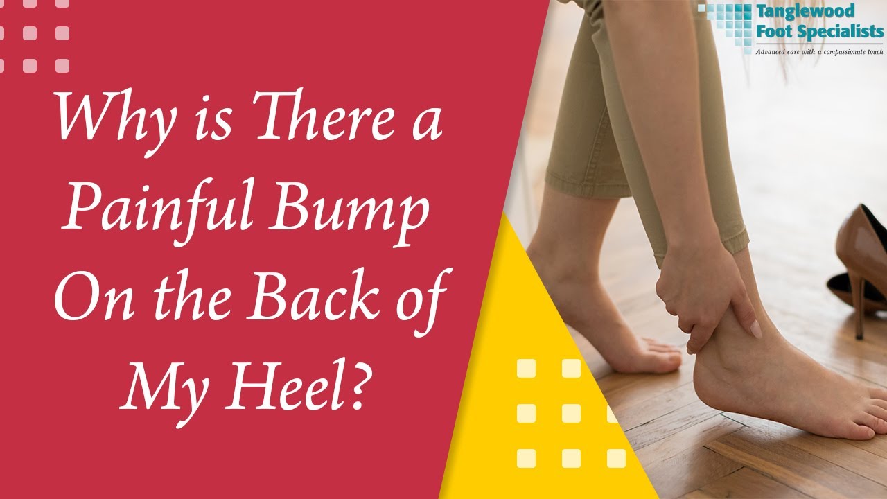 Why is There a Painful Bump on the Back of My Heel?