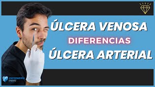 🔍¿Cómo DIFERENCIAR una ÚLCERA Venosa de una Arterial [ ETIOLOGÍA ]✔️