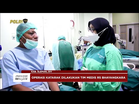 PRESISI UPDATE: POLDA DIY GELAR OPERASI KATARAK, SAMBUT HARI BHAYANGKARA KE-79 16/06/25 (16.00)