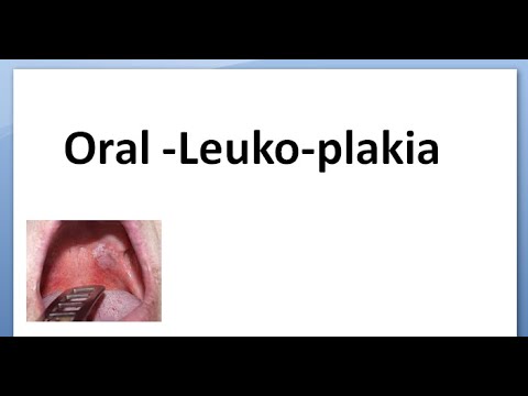 prosztatagyulladás hatása az erekcióra