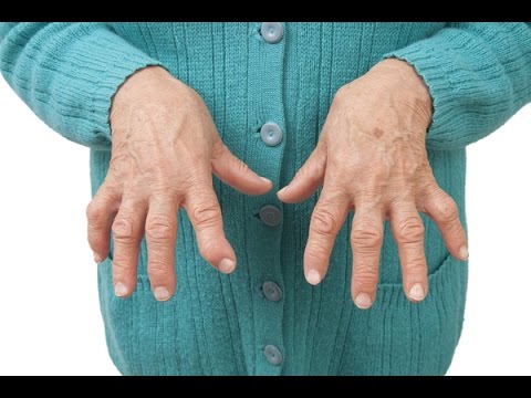 Il mal di schiena che si estende per larticolazione dellanca Giunti rigidi nei fianchi e ginocchia