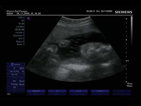 Emma Bosio - Noviembre de 2008