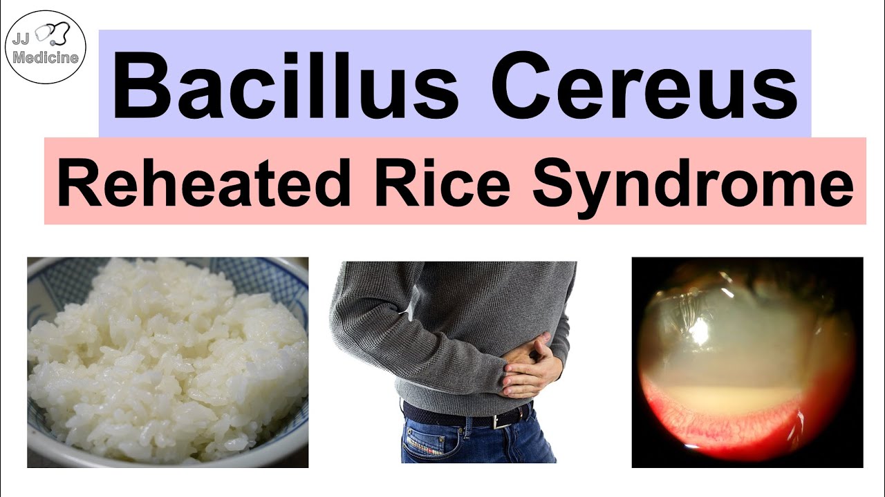 Bacillus Cereus (Reheated Rice Syndrome) Food Poisoning, Pathology, Symptoms, Diagnosis, Treatment - YouTube