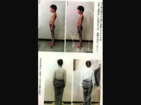 歯も抜かず、神経も取らず、体のバランスを考えます イメージ1