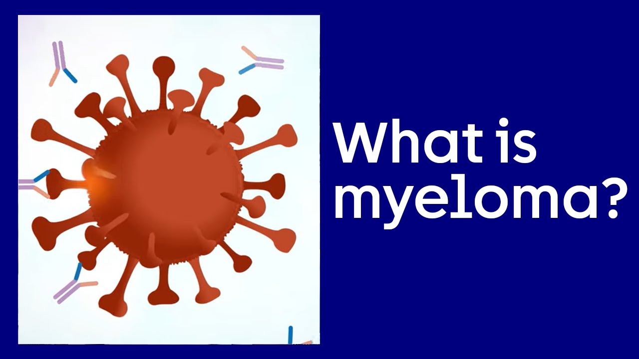 What is Myeloma? | Cancer Research UK 2021
