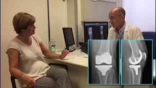 “Recuperación rápida” en prótesis de rodilla