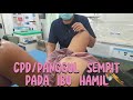 CPD Panggul Sempit Pada Ibu Hamil