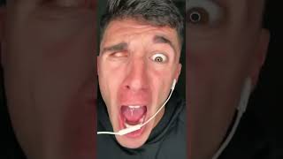 Download lagu My Eye ball slpped out #shorts🤪 mp3