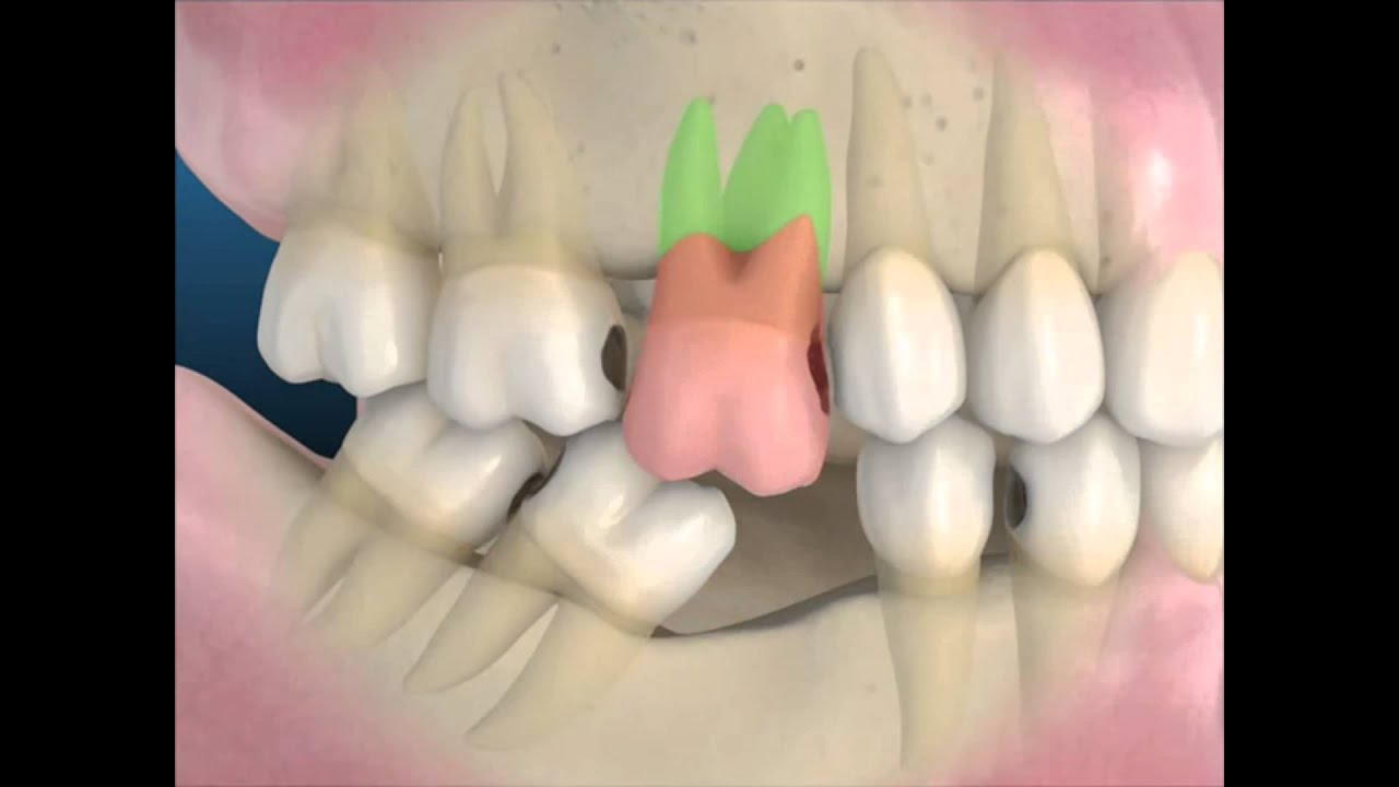 Leandro Ponte Dias-52