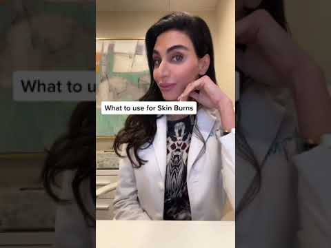 How to treat Skin Burns #shorts