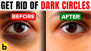 Get Rid Of Dark Circles Permanently With These 8 Effective Tips