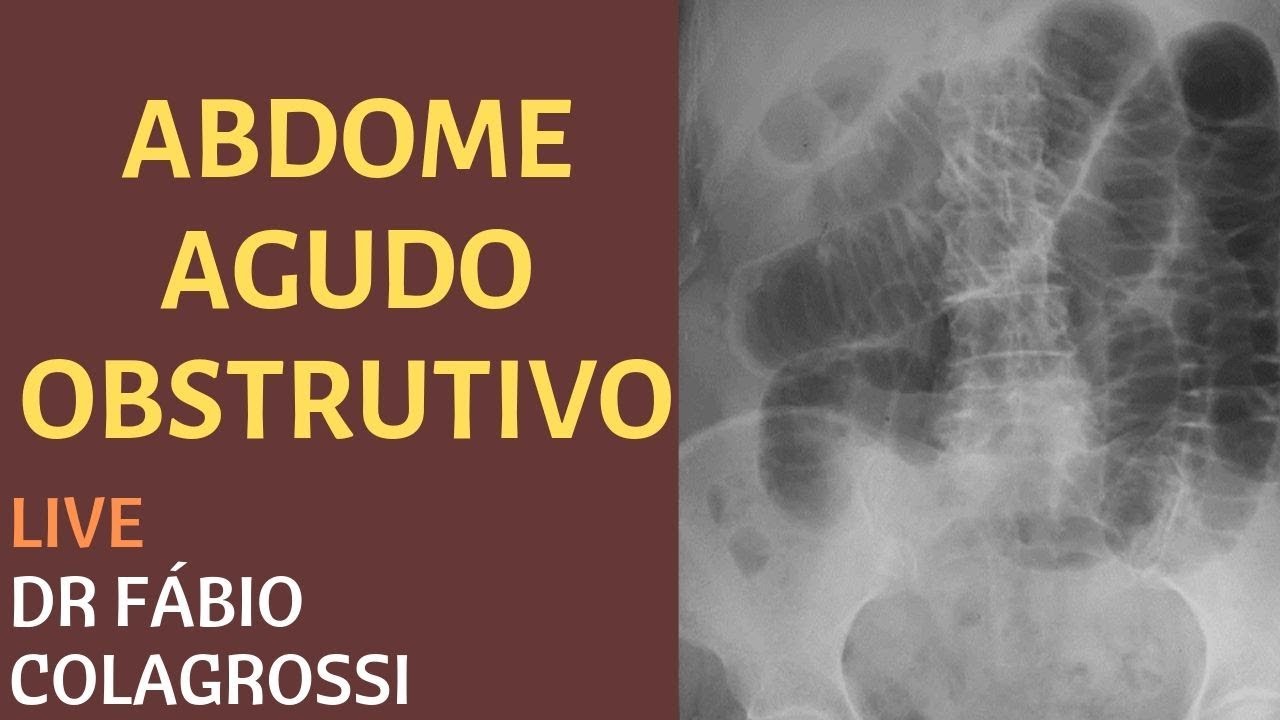 ABDOME AGUDO OBSTRUTIVO - LIVE