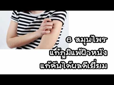 โรคสะเก็ดเงินและโรคผิวหนัง seborrheic พร้อมกัน กลาก Nummular เกี่ยวกับการรักษามือของพวกเขา
