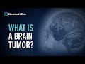 Primary Brain Tumors | What Are They and How Do They Form?