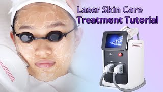 Laser Hair Removal SHR Skin Rejuvenation Tattoo Removal IPL