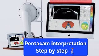 Corneal topography interpretation ..Step by Step ...in details