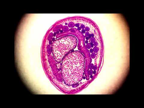 a nőstény Ascaris reproduktív szervei