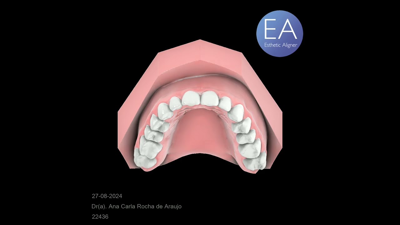 Ana Carla Rocha De Araujo-20
