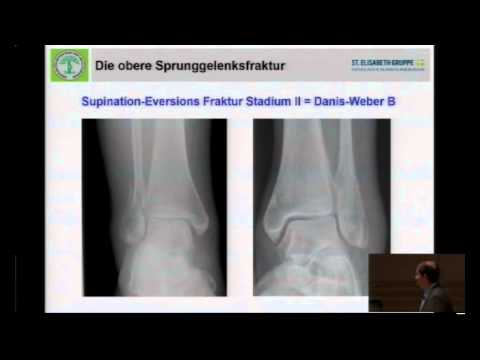 Wie man die Schmerzen in Osteochondrose nach Hause zu lindern Welche Medikamente mit Herzschmerzen in Osteochondrose