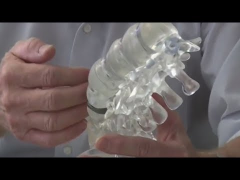 Wie man helfen mit cheirarthritis Die koronale Gelenkarthrose
