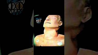 #radiohead - &quot;Sulk&quot; (The Bends, 1995)