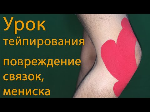 Бубновский комплекс при остеохондрозе Боли в челюстном суставе лечение
