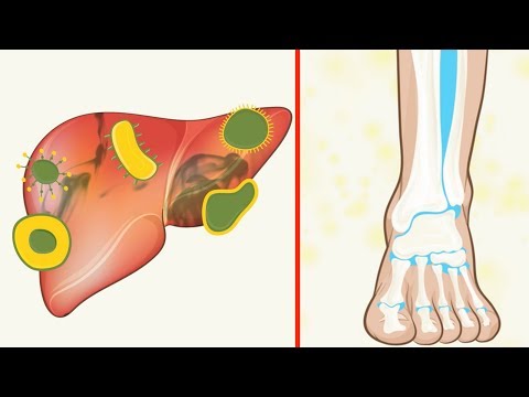 Voilà ce qui arrive quand on boit du citron chaud pendant huit semaines.