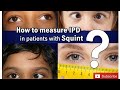How To Measure IPD In Patients With Squint Inter Pupillary Distance