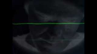 Andrew Poppy - THEN IT WAS OVER - Shiny preview (edit)