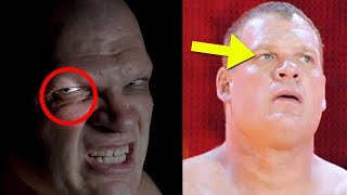 What Happened to Kane’s Eye? - 5 Things WWE NEVER Explained About Kane!