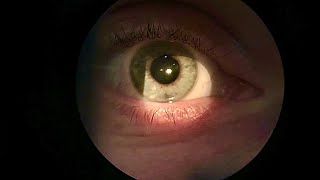 ASMR: Real Person Slit Lamp exam (Optometrist pov!)