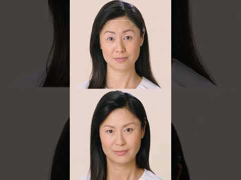 Connecticut's Top BOTOX Team #botox #connecticut #guilford #beforeandafter